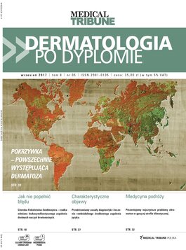 Dermatologia po Dyplomie (05/2017) 