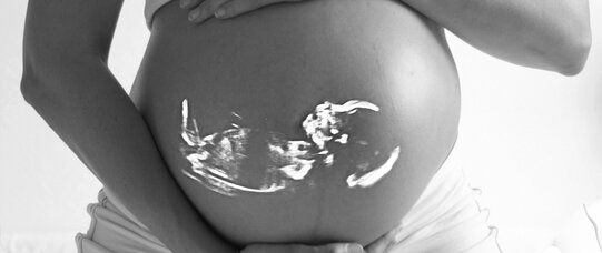 Ośrodki rehabilitacyjno-psychologiczne zamiast aborcji