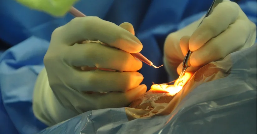 Implant steroidowy w terapii chorób siatkówki zastosowany w Kielcach