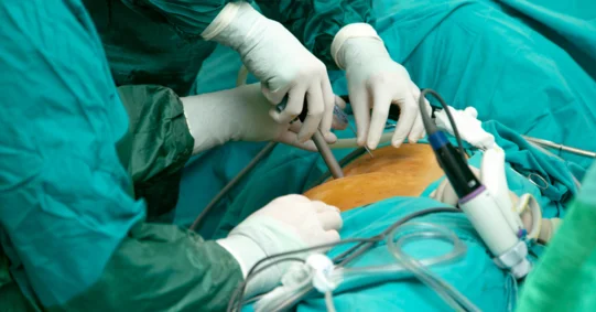 Operacje bariatryczne u dzieci. Chirurdzy zdecydowali się operować pacjentkę ponownie