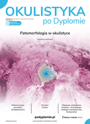 Okulistyka po Dyplomie 04/2021