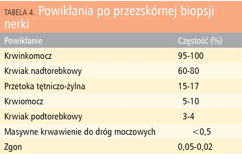 Tabela 4. Powikłania po przezskórnej biopsji nerki