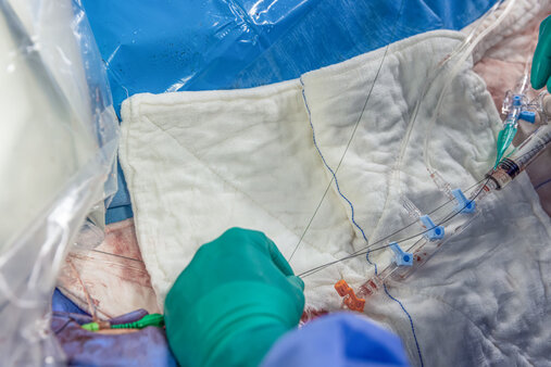 Szpital uruchomił drugi zespół TAVI