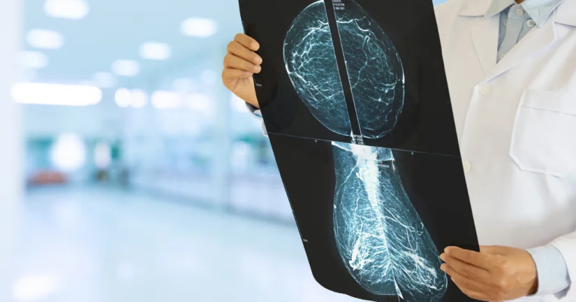 Dofinansowanie na mammografy w Zachodniopomorskim Centrum Onkologii