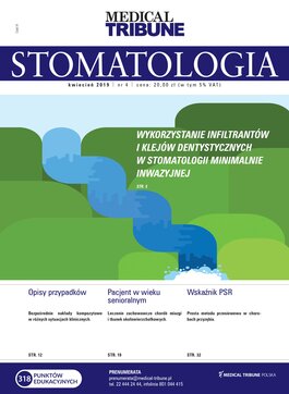 Medical Tribune - stomatologia (04/2019) 