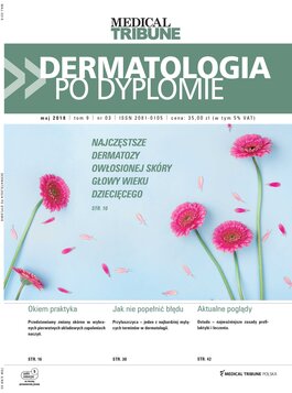 Dermatologia po Dyplomie (03/2018) 