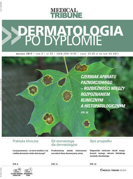 Dermatologia po Dyplomie (02/2017) 