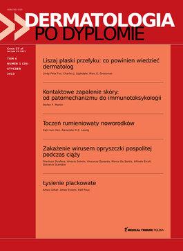 Dermatologia po Dyplomie (01/2013) 
