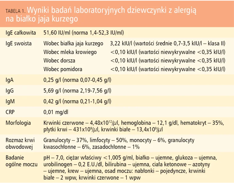 Tabela 1. Wyniki badań laboratoryjnych dziewczynki z alergią na białko jaja kurzego