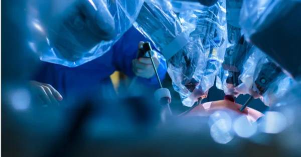 Ponad 100 operacji raka jelita grubego z pomocą robota w Lublinie