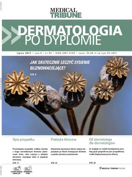 Dermatologia po Dyplomie (04/2017) 