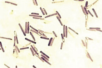 Rycina 1. Clostridium difficile. Proces tworzenia się spór