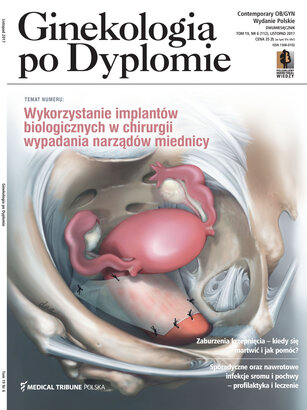 Ginekologia po Dyplomie 06/2017