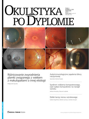 Okulistyka po Dyplomie 02/2016