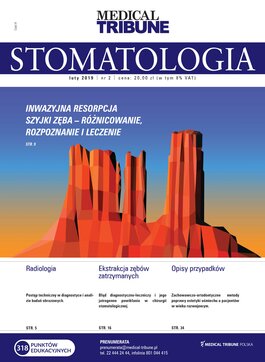 Stomatologia po Dyplomie (02/2019) 