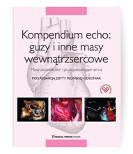 Kompendium echo: guzy i inne masy wewnątrzsercowe. Masy zastawkowe i pozazastawkowe serca
