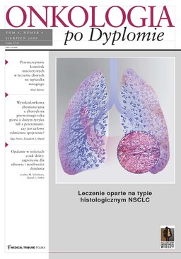 Onkologia po Dyplomie (04/2009) 