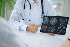 Neurolodzy: potrzebujemy zintegrowanej opieki udarowej
