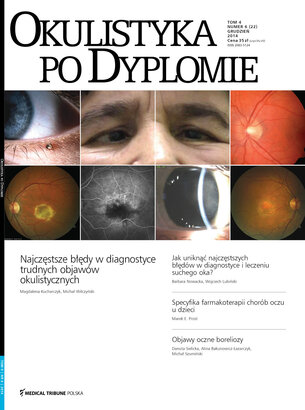 Okulistyka po Dyplomie 06/2014