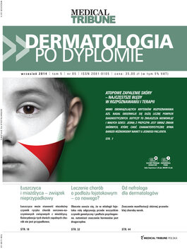 Dermatologia po Dyplomie (05/2014) 