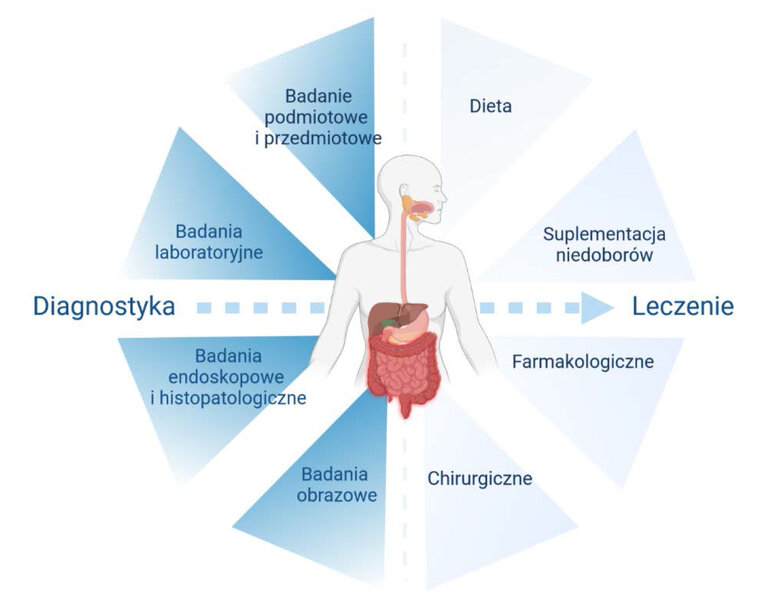 Rycina 1. Postępowanie diagnostyczne w nieswoistych chorobach zapalnych jelit i ich leczenie