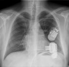 ci Zakładu Radiologii Instytutu
