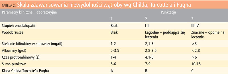 Tabela 2. Skala zaawansowania niewydolności wątroby wg Childa, Turcotte’a i Pugha