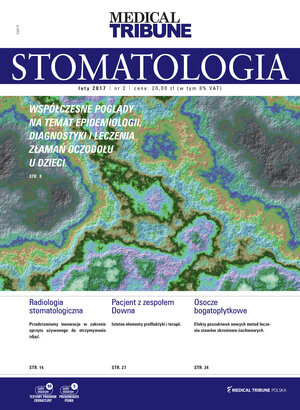 Stomatologia po Dyplomie 02/2017