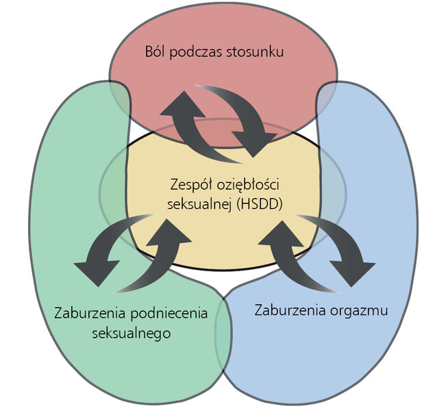 Rycina. Wzajemne zależności między 4 typami FSD.