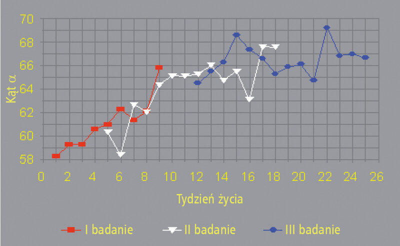 Rycina 3. Wykres ilustrujący normalizację ultrasonograficznego parametru określającego kąt nachylenia stropu kostnego (tzw. kąt α) w pierwszych tygodniach życia.8