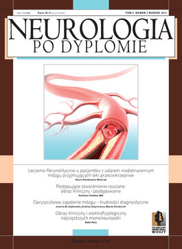 Neurologia po Dyplomie (02/2013) 