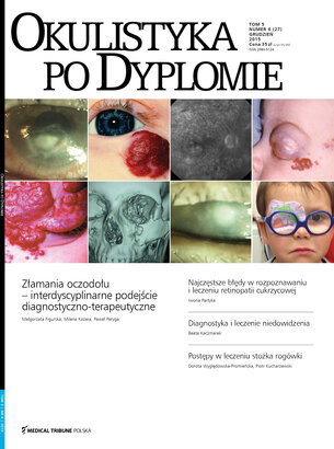 Okulistyka po Dyplomie 06/2015