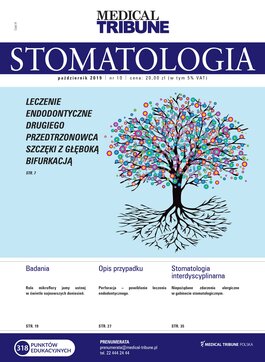 Stomatologia po Dyplomie (10/2019) 