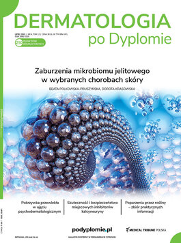 Dermatologia po Dyplomie (04/2021) 