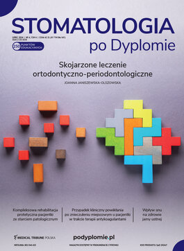 Stomatologia po Dyplomie (04/2024) 