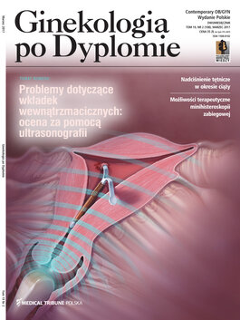 Ginekologia po Dyplomie (02/2017) 
