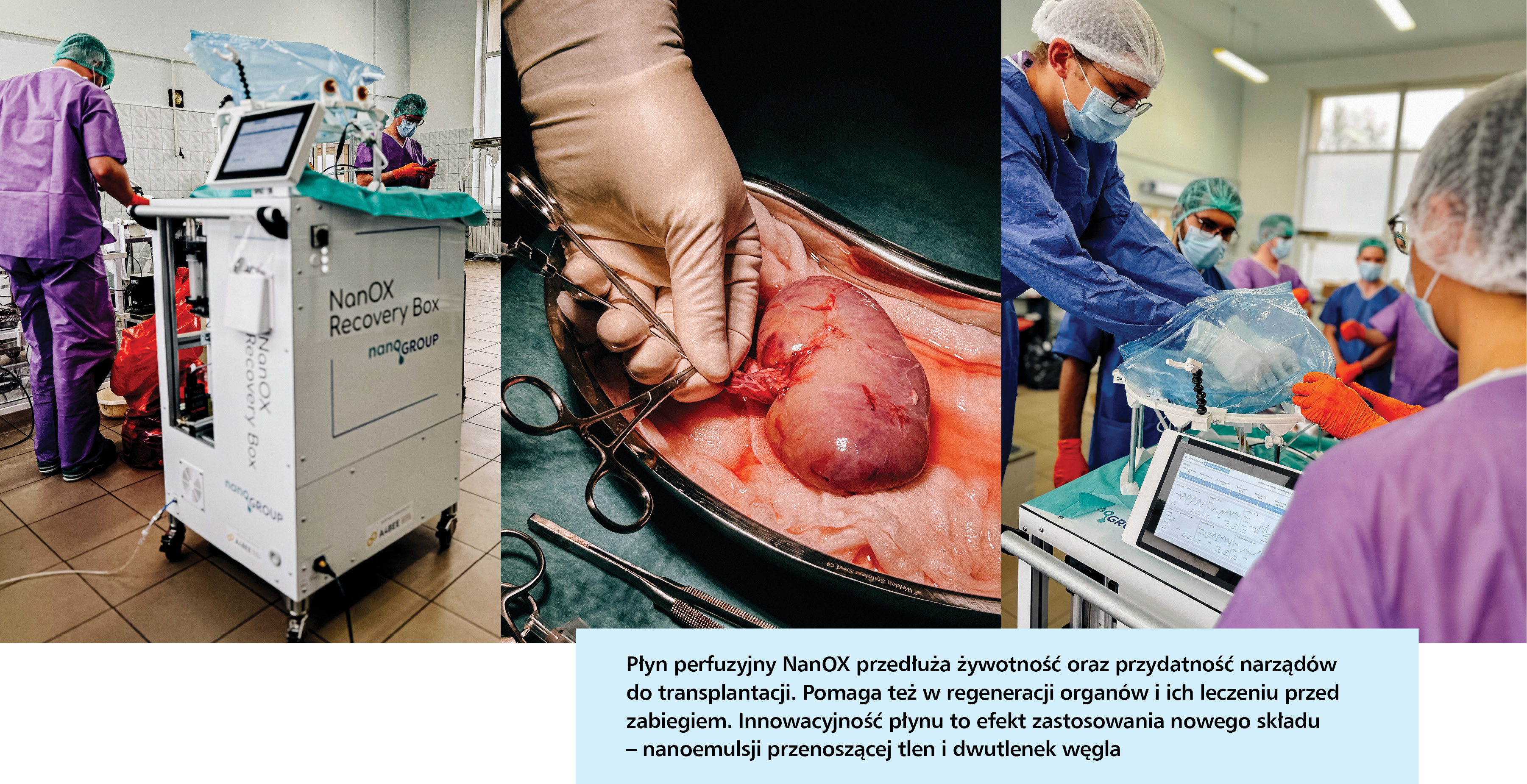 Lekarze mają pomysł, jak zwiększyć liczbę transplantacji