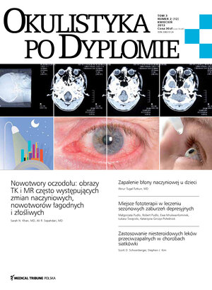 Okulistyka po Dyplomie 02/2013