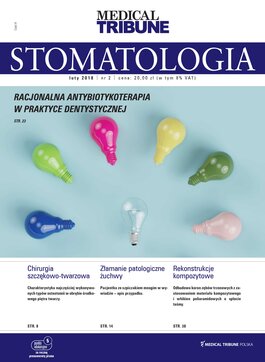 Stomatologia po Dyplomie (02/2018) 