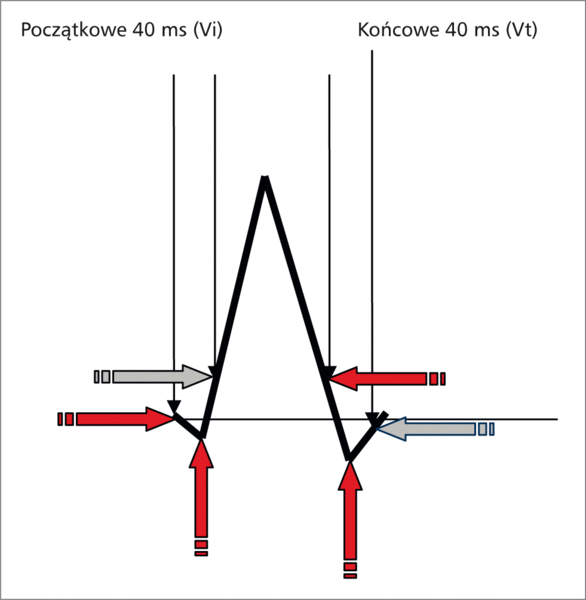 Rycina 6. Obliczanie Vi/Vt.