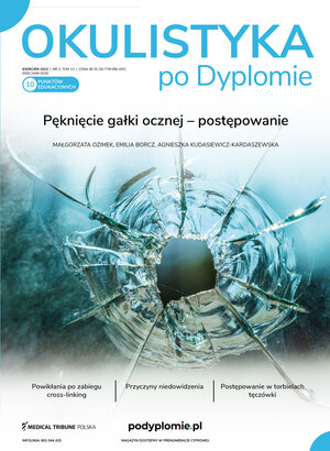 Okulistyka po Dyplomie 02/2022