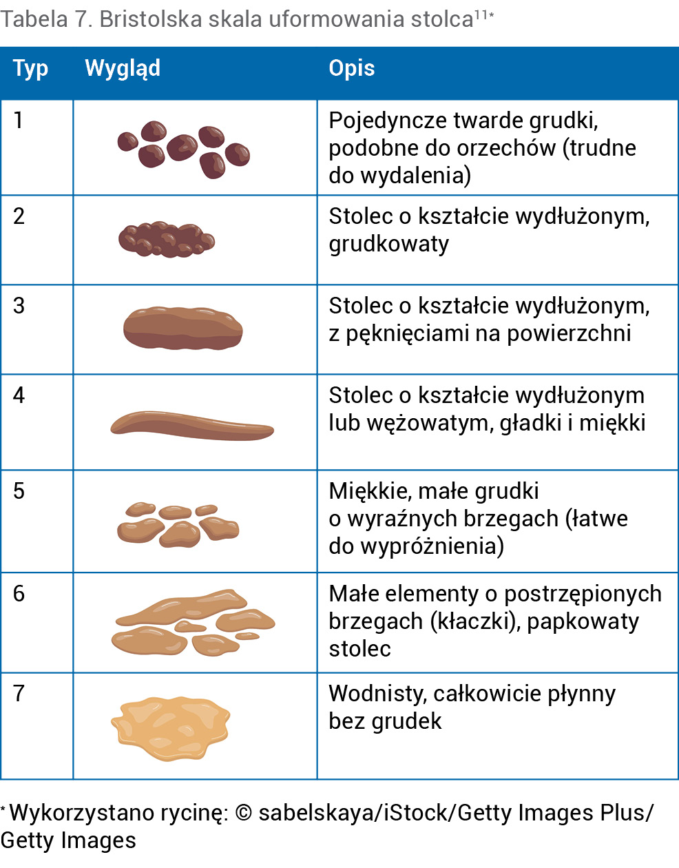 Tabela 7. Bristolska skala uformowania stolca11*