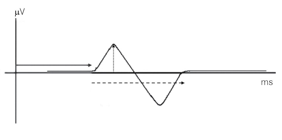 Rycina 3. Parametry potencjału czuciowego.