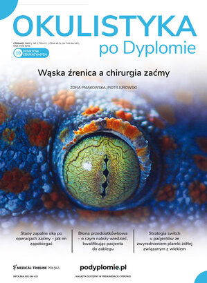 Okulistyka po Dyplomie 03/2022