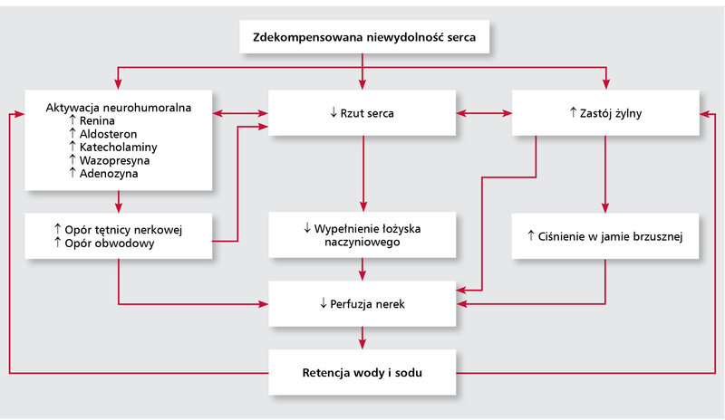 Rycina 1. Patomechanizm retencji płynów i sodu u chorych ze zdekompensowaną niewydolnością serca.
