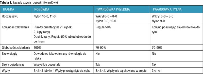 Tabela 1. Zasady szycia rogówki i twardówki