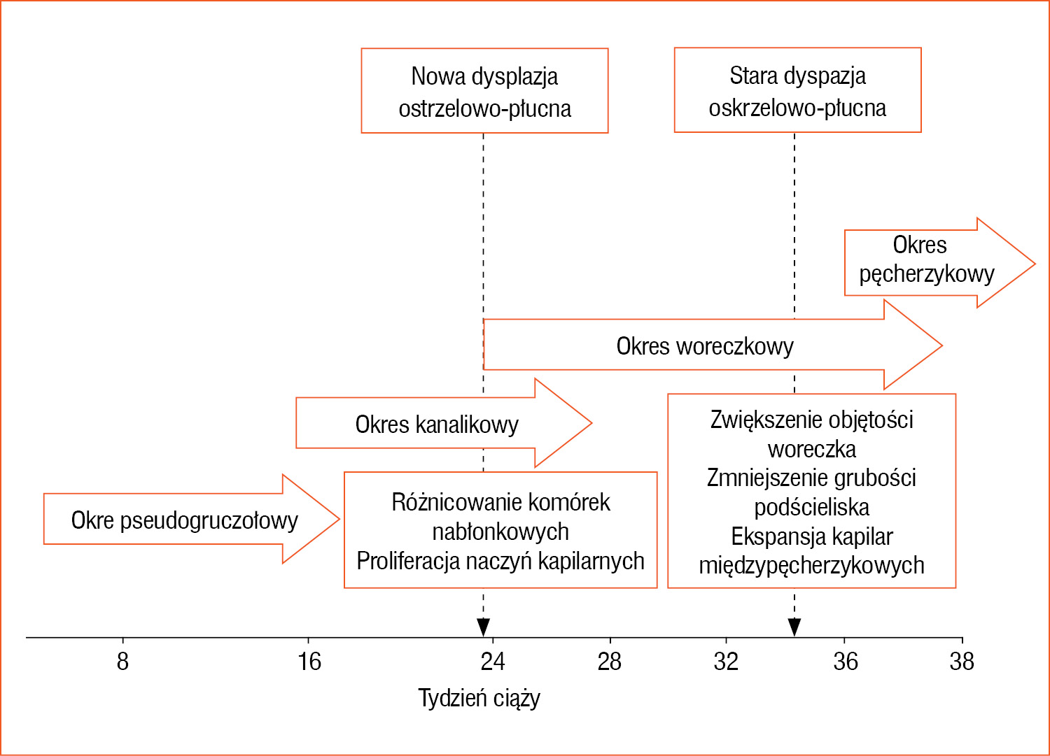 Rycina 1. Związek między dysplazją oskrzelowo-płucną a etapami rozwoju układu oddechowego (opracowanie własne na podstawie pozycji piśmiennictwa 1)