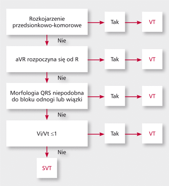 Rycina 5. Algorytm Vereckei’ego.