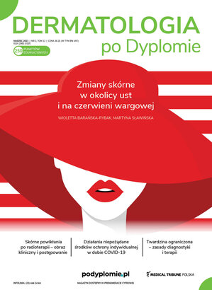 Dermatologia po Dyplomie 02/2021