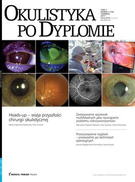 Okulistyka po Dyplomie (03/2017) 